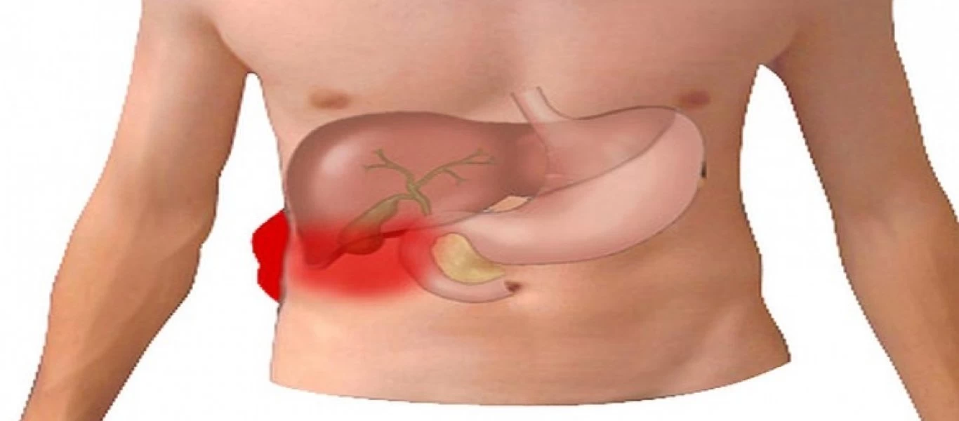 Δείτε τα συμπτώματα και τους τρόπους αντιμετώπισης για τις πέτρες στη χολή